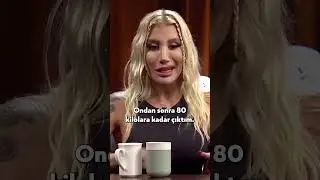 İrem Derici'nin Vücudunda En Sevmediği Yer! 