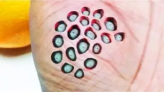 Berarti Anda MENGIDAP Penyakit Trypophobia