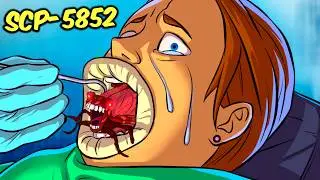 SCP-5852 - "You've got teeth in your bugs."