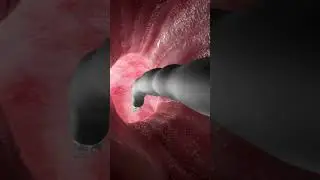 Shrink Your Stomach Without Surgery (3D Animation)