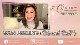 EPISODE 60 THE MISS O SHOW | SKIN PEELING : DO's AND DON'T's