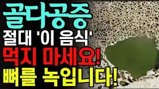 골다공증 '이 음식' 절대 먹지 마세요! 골다공증 최악음식 3가지와 잘 걸리는 경우 3가지! 골다공증 금기 음식! 좋은 음식 알고 드세요! 항암 음식. 치매 음식. 당뇨 음식.