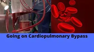 Going on Cardiopulmonary Bypass