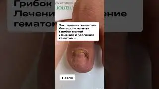 Моя любимая работа #выжившие #путешествия #израиль #уехавшие #переезд #знания #подология