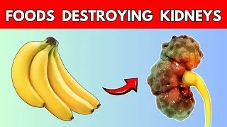 These 7 Foods Are Destroying Your Kidney Health | Part -2