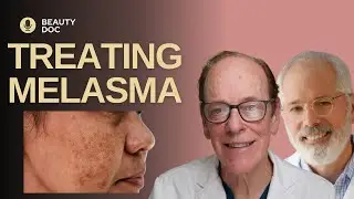 Treating Melasma Effectively for All Skin Types