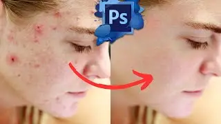 Photoshop: remove blemishes with AI