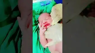 Newborn afterbirth video/Nursing care of Newborn#trending#viral#short