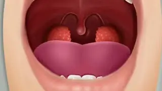 tonsil removal surgery simulator