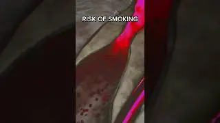 SMOKING LEADS TO HEART ATTACK 