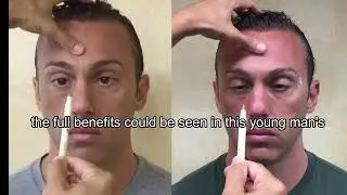 Improve VISION with These Simple Eye Exercises