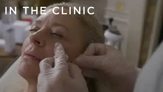When fillers go wrong....