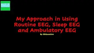 My Approach to Using Routine EEG, Sleep EEG and Ambulatory EEG
