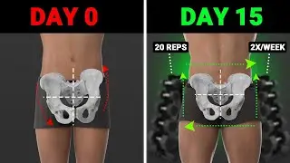 The Best Weight Training Exercises To Fix Lateral Pelvic Tilt (asymmetrical hips)