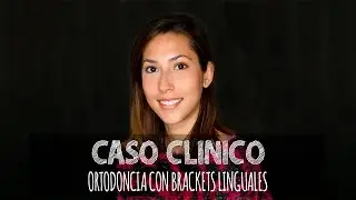 Caso clínico - Ortodoncia con brackets linguales (Incognito). Explicación Dra. Patricia Bratos