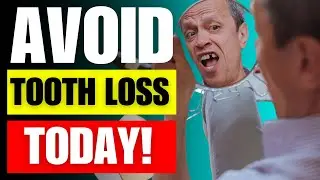 Avoid Tooth Loss with These Expert Prevention Strategies!