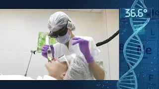 Купероз на лице: лечение лазером быстро и эффективно.