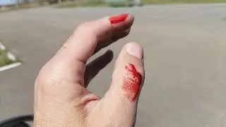 Руки в крови! Как спасти ЧЕЛОВЕЧЕСТВО?!