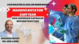 Massive Rotator Cuff Tear: (SCR) Superior Capsular Reconstruction - Master Class LIVE