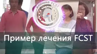 Моментальный эффект после применения FCST терапии