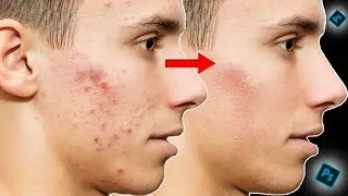 How to Clean Your Face in Photoshop | Remove Pimples, Blemishes and Acne Easily