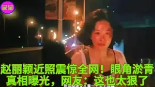 赵丽颖近照震惊全网！眼角淤青真相曝光，网友：这也太狠了