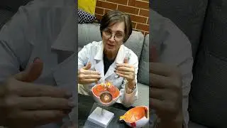 Что такое астигматизм
