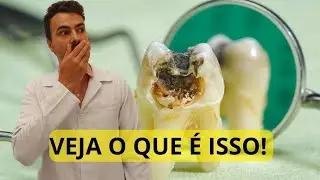 Como EVITAR? veja como tratar