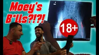 X-Ray gone wrong!