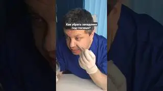Как убрать западения под глазами?