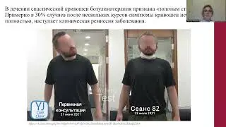 Ботулотоксин.  Его применение в неврологии.  Иванова Лариса Борисовна.