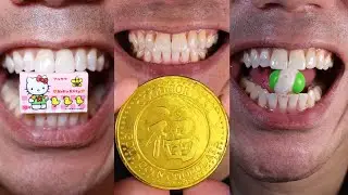The Craziest Chocolate and Candy Chewing You’ll Ever Hear Doctor Tristan Peh ASMR