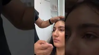 lip filler complete process with dr abbas ashrafzade
