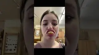 Наглядное видео как заживают губы 👄 после увеличения