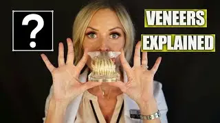 Dentist Tells All About Veneers