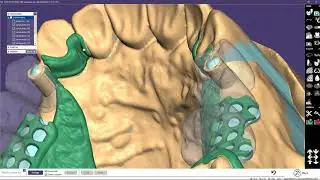 INSIGHTS 2018  PartialCAD Case Demonstration   Bridge with attachments and partial Part II