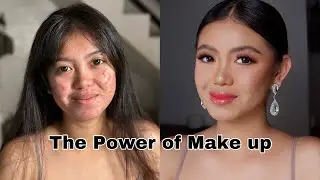 HOW TO COVER PIMPLES USING MAKE UP | Make Up By Sydney De Taza