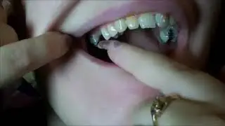 Mouth tour with bad teeth