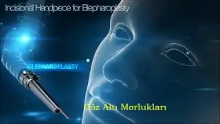 Fraksiyonel Lazer
