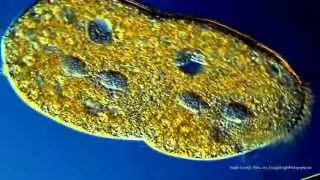 Four Heads Are Better Than One! A Quad-nucleated Protozoan During Cell Division.