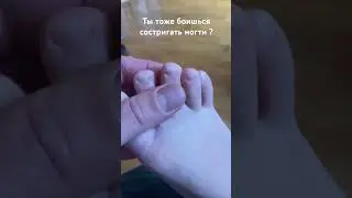 Ты тоже боишься состригать ногти ?) 