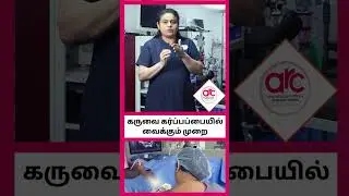 Embryo Transfer Procedure Shorts