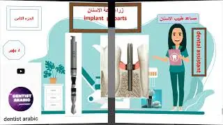 #زراعة_الأسنان الجزء الثامن #سلسله_مساعد_طبيب_الاسنان #dental_assistant