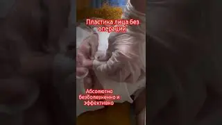 У вас кривой нос? Искривление носовой перегородки? Ручная ринопластика #лаурасатумян  #ринопластика