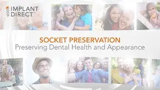 Socket Preservation - Preserving Dental Health and Appearance