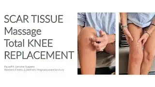 Scar Tissue Massage, Knee Replacement