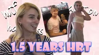 1.5 Years on Hormones - MtF Look How Much Has Changed in 6 Months!