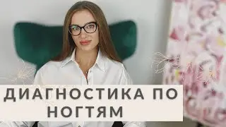 ЧТО ВАШИ НОГТИ РАССКАЖУТ О ЗДОРОВЬЕ | ДИАГНОСТИКА БОЛЕЗНЕЙ ПО НОГТЯМ ОТ НУТРИЦИОЛОГА