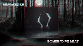 [FREE] Bones Type Beat 