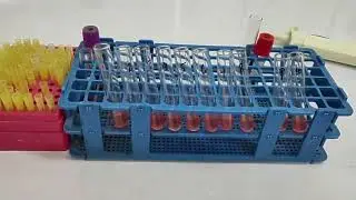 Agglutination Reaction